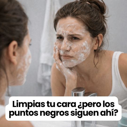 Removedor Eléctrico de Puntos Negros y Grasa Facial con Succión Ajustable