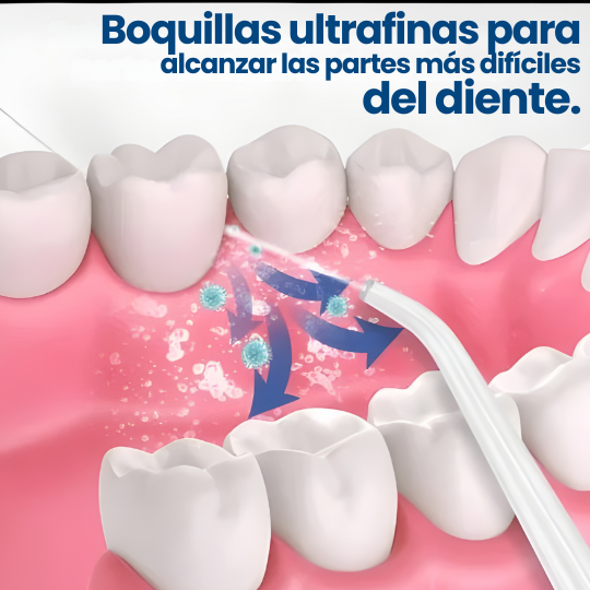 Irrigador Bucal - ¡Lava tus dientes, lengua y encías con agua a presión!
