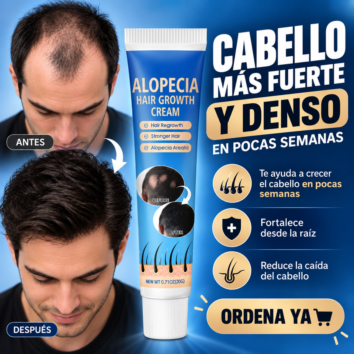 Crema Capilar Anticaída Y Crecimiento Intensivo - Para Cabello Débil Y Escaso ¡Dile Adiós a la Alopecia!