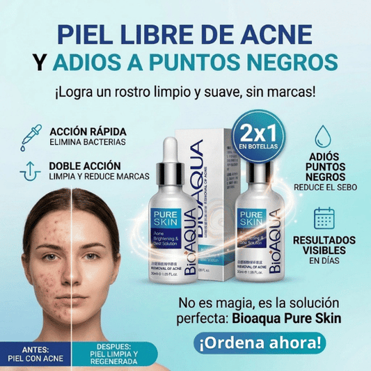 Sérum Facial Anti Acné y Puntos Negros para Piel Grasa - Sin Sensación Grasosa ¡Piel Sin Acné!
