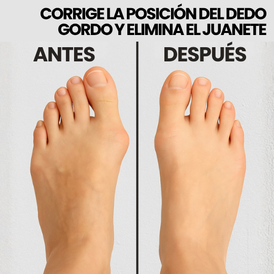 Corrector Juanete Ferula Dedo