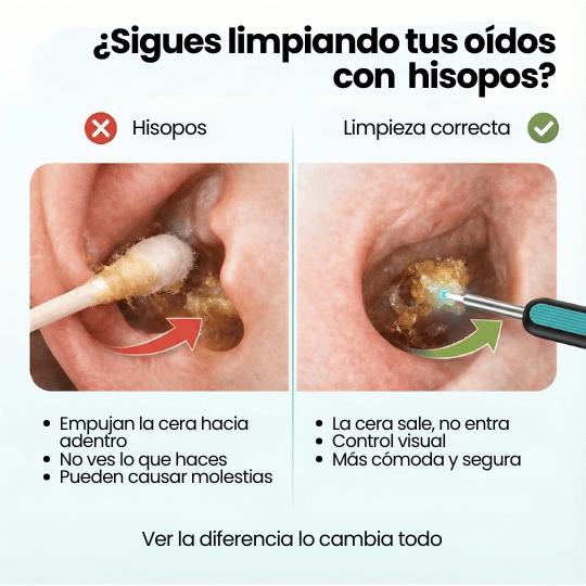 Limpiador de Oídos con cámara integrada, WiFi y Luz LED - ¡Limpieza profesional desde casa!