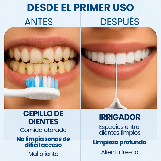 Irrigador Bucal - ¡Lava tus dientes, lengua y encías con agua a presión!