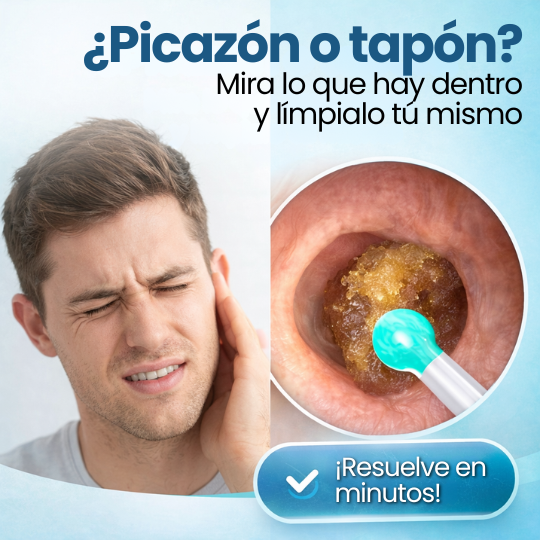 Limpiador de Oídos con cámara integrada, WiFi y Luz LED - ¡Limpieza profesional desde casa!